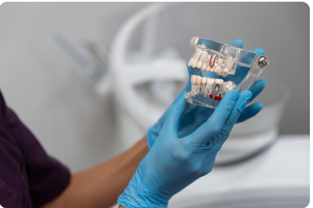 all-on-4 and all-on-6 dental implants at diagnopein mumbai 